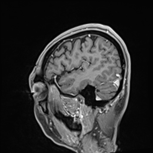 Click on the Serie image to view the images of VILLANUEVA, WILLIAM A.